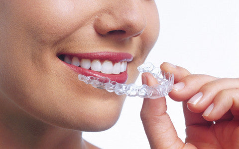 Invisible braces – The Dentist at Chiswick, London W4
